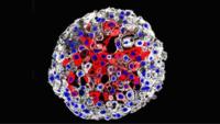 Image of a bladder organoid from the Shen lab